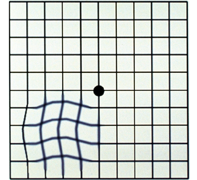 alt mce_tsrc=images/stories/amsler%20grid.jpg